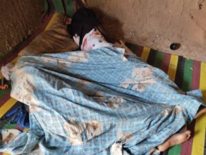 مأساة النزوح … موت طفل بحثاً عن طعام في مكب للنفايات